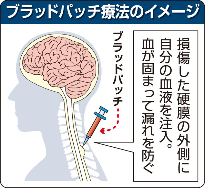 公明党　脳脊髄減少症